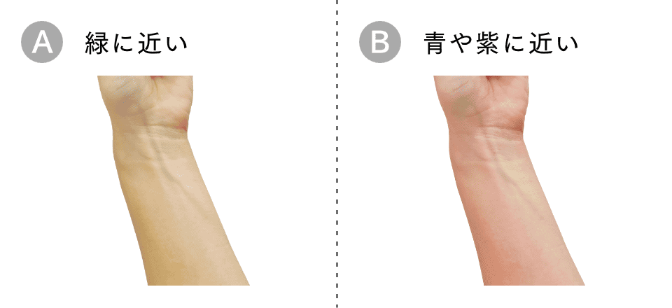 手首の血管の色