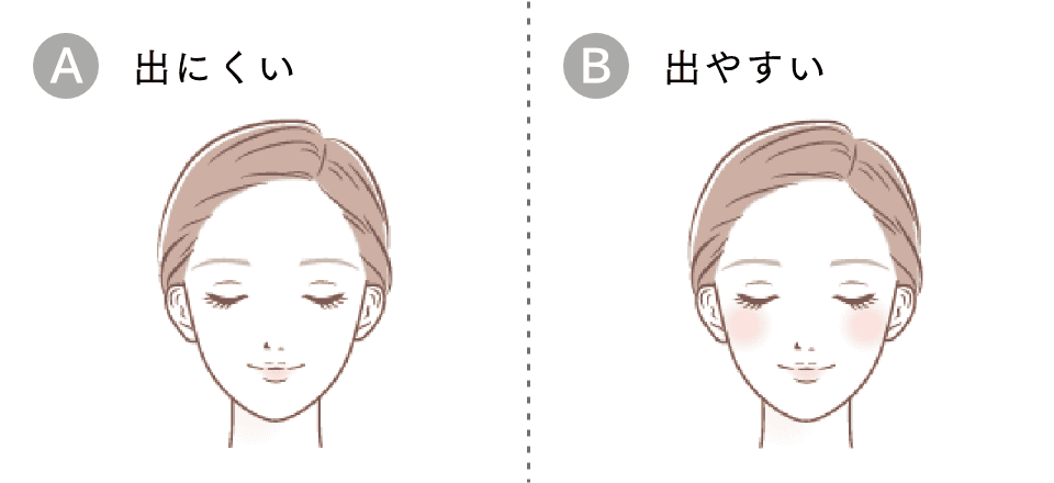 顔に赤みが出やすい